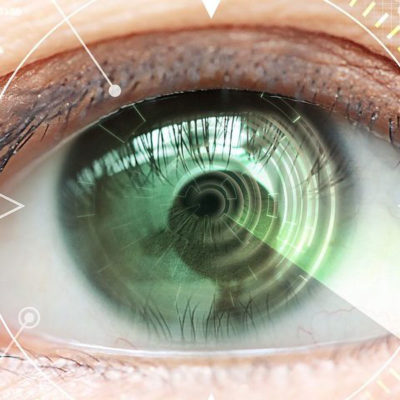 Cataracte oeil présentant des traces de cataracte