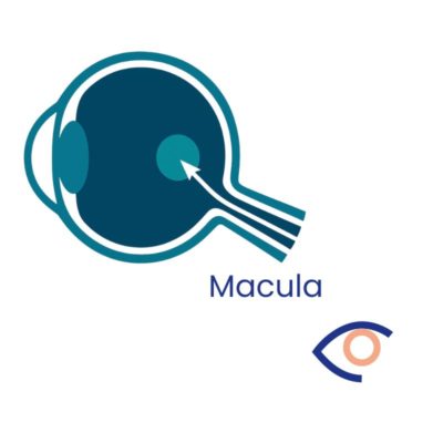 Macula-dmla-nimes infographie d'un oeil montrant la macula avec le logo de ophtacenter centre ophtalmologique à Nimes